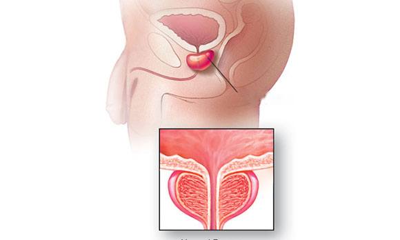 Простата мужчины