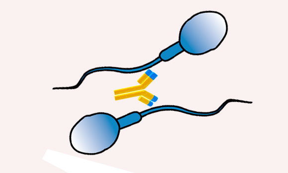 Антитела склеивают сперматозоиды