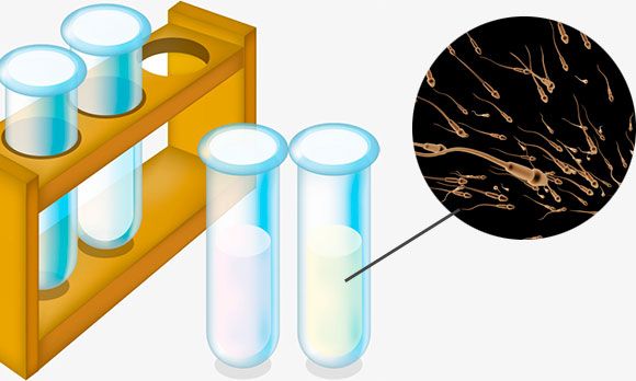 Сперма в пробирке