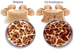 Почему болит копчик у мужчины?