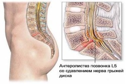 Почему болит копчик у мужчины?