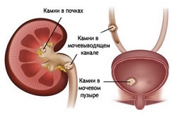 Почему наблюдается боль в пояснице у мужчин?