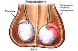 Почему наблюдается боль в пояснице у мужчин?