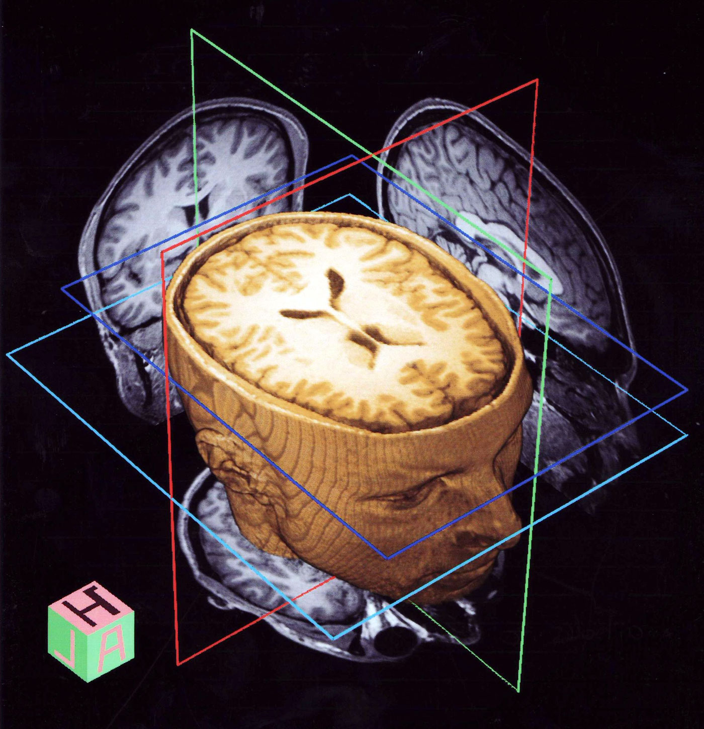 Плюсы 3D томографии