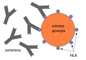 HLA-типирование супругов: значение генетической совместимости для репродуктивного здоровья